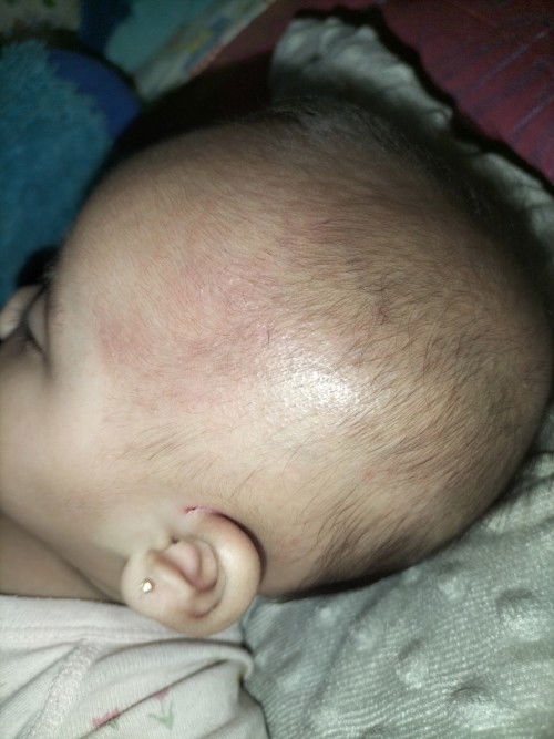 Ngilangin biang keringat