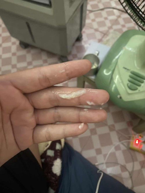 อันนี้คือตกขาวหรืออะไรค่ะ