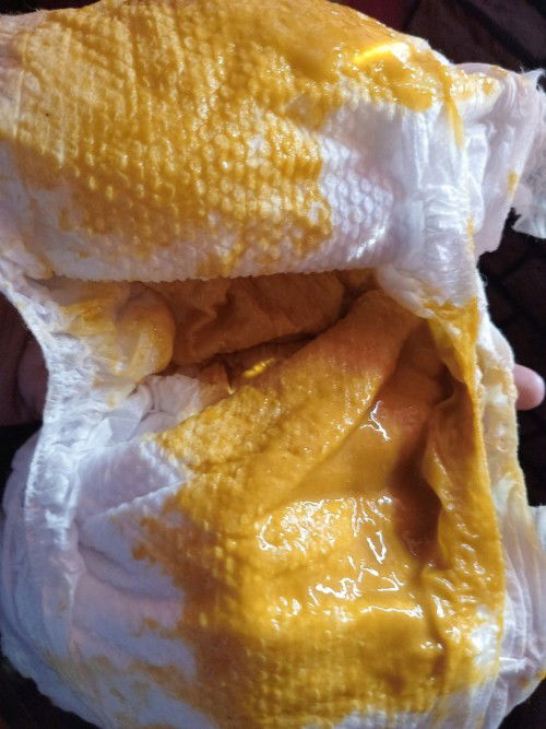 Basa ang poops ni baby at 7 months old.