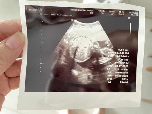 ทีมสิงหาคม แชร์น้ำหนักลูกกันหน่อยค่ะ