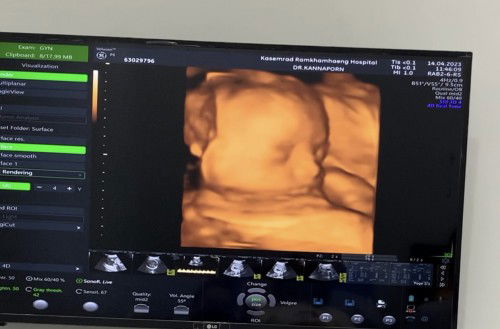 ขอพื้นที่อวดลูกสาวหน่อยจ้า 🥰🤭