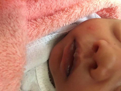 ลูกปากสีนี้ปกติไหมค่ะ