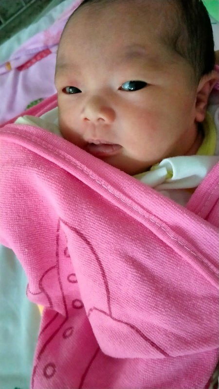 แตกแล้วจร้าเด็กคลอดก่อนกำหนด