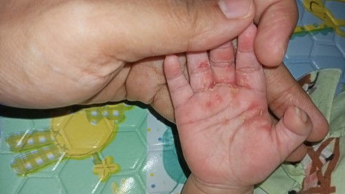 Bun, kira2 ini kenapa ya . Udah hmpir 2 minggu blm sembuh2,