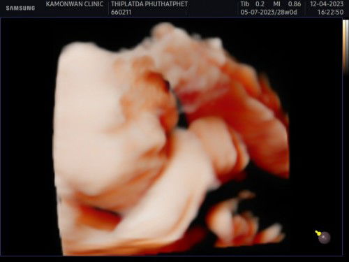 ขอพื้นที่อวดลูกสาวค้าา