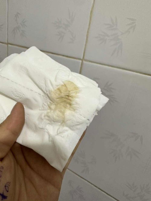 Em Lo lắng quá ạ 🥺🥺🥺