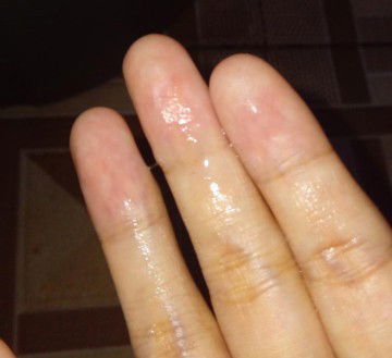 Keputihan atau ketuban