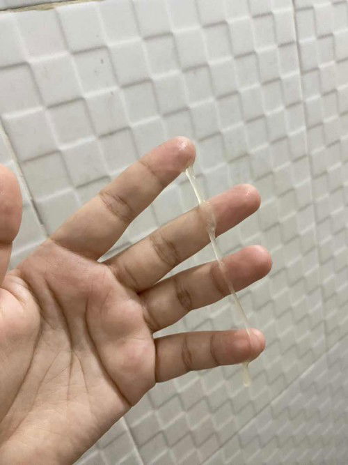 Ini apa yaa normal ga bun?