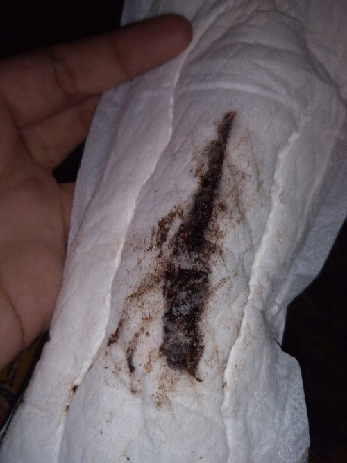 Nk tanya. Maaf gambar agak kotor.