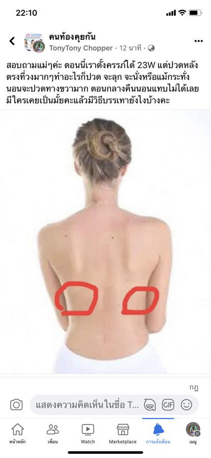 ท้อง 2 ตอนนี้ได้ 23W ปวดหลังมากๆ