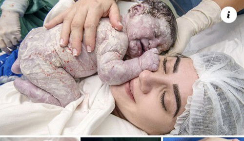 Lapisan putih pada bayi