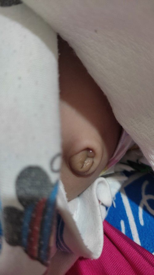 Pinagtanggalan ng umbilical cord