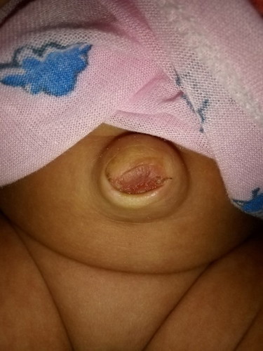 One month old baby