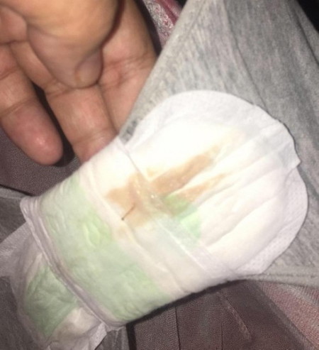 Mucus plug po ba?