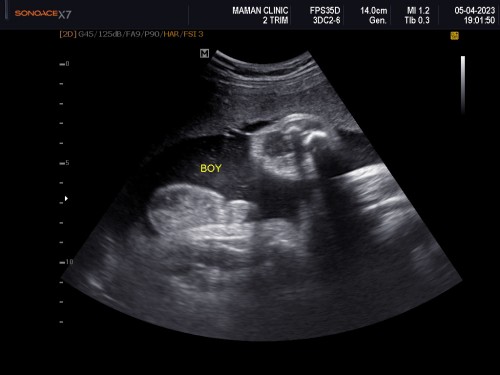 น้องงงงงงงงงงงง