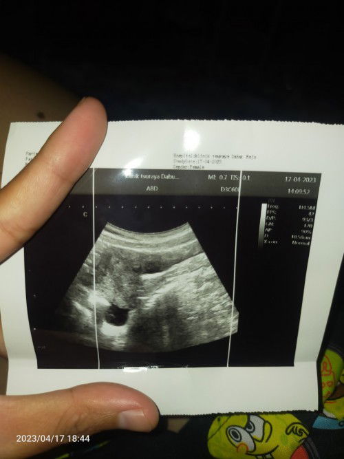 HPHT 22 feb 23 tespek ( -)