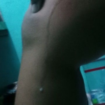 Normal ba?
