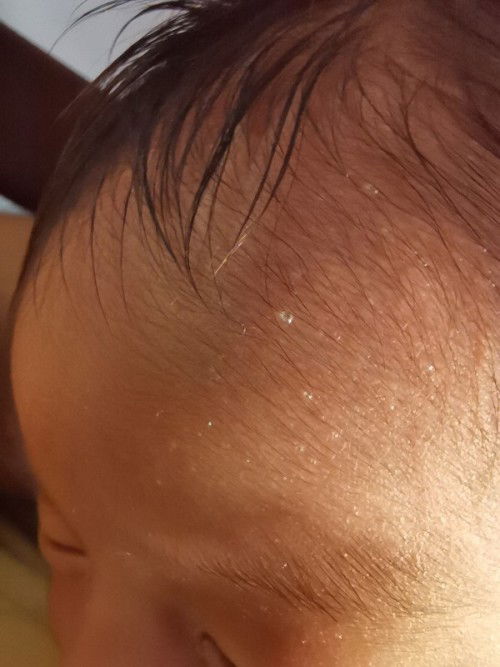 Ano po kaya itong nasa skin ni LO?