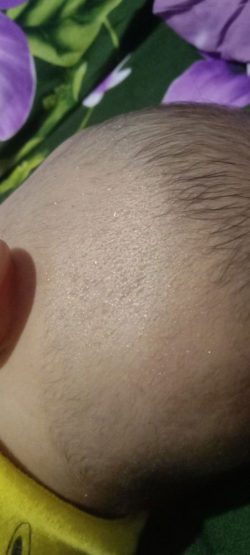 Keringetan saat menyusui atau sedang bermain