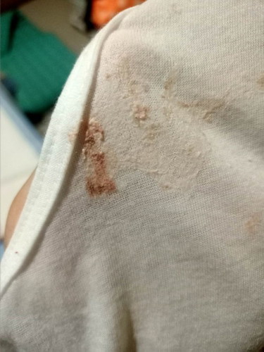 Ibang kulay ng lungad ni baby