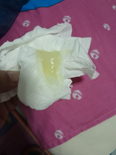 แบบนี้ใกล้คลอดยังค่ะ