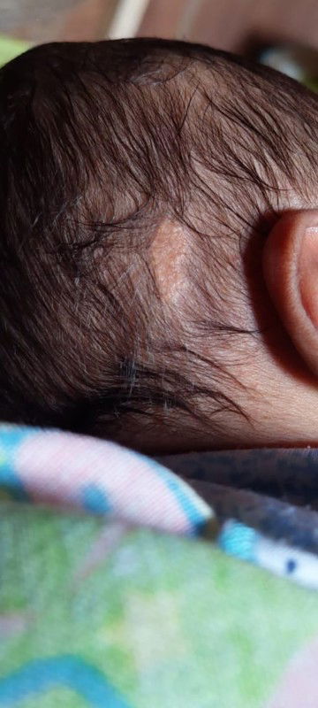 Sejak lahir ada seperti ini