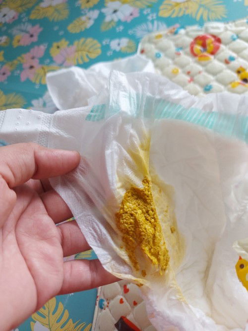 สอบถามแม่ๆคะ พอดีน้องอายุได้20วัน กินนมแม่ เสริมนมผง แล้วทุกครั้งที่กินเสร็จน้องจะถ่ายตลอด สีปกติไหม