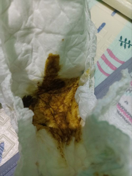 Bab bayi setelah mpasi