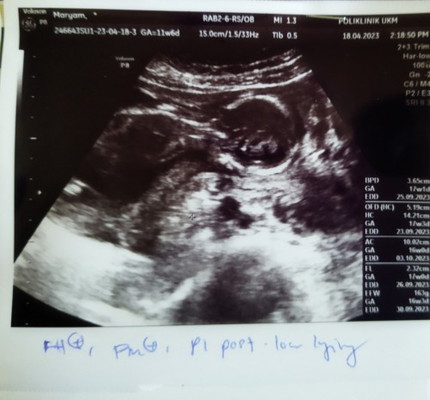 16 weeks