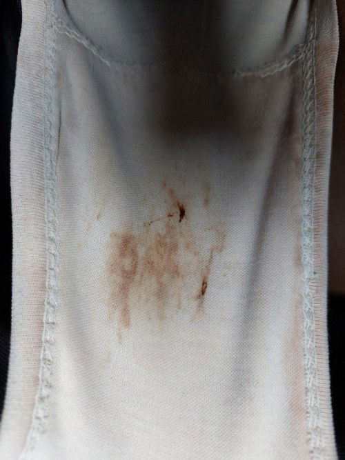 Flek usia 7 mnggu 3hri