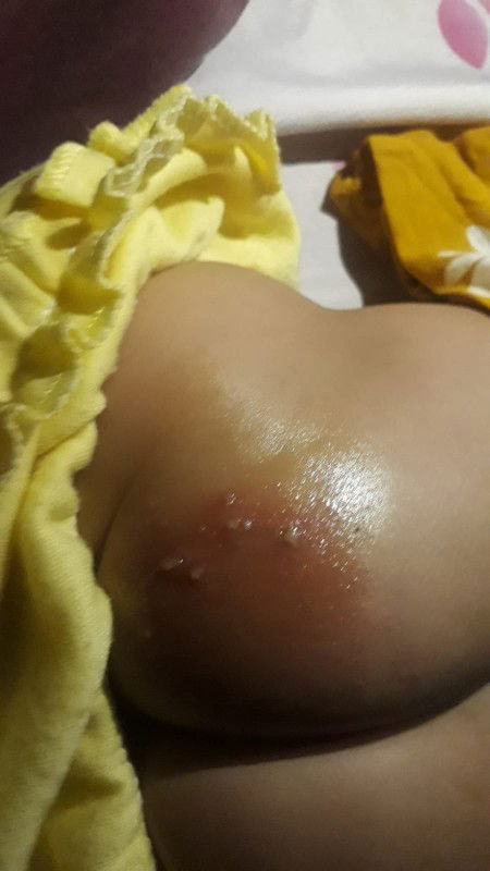 Kenapa dan obatnya apa ?