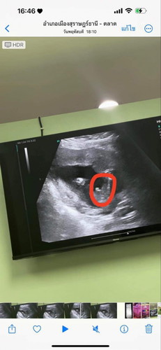 ช่วยดูเพศลูกให้หน่อยค่ะ