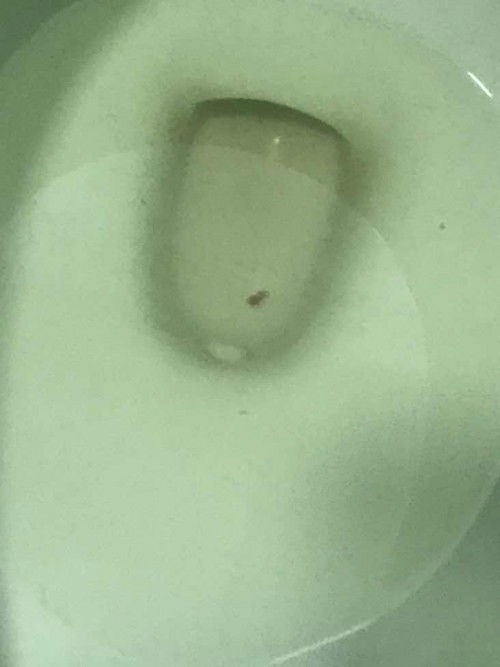 ตั้งครรภ์ 39 w อาการแบบนี้ใกล้คลอดยังคะ ควรไปพบแพทย์หรือรอให้มีอาการอื่นร่วมด้วยคะ ?