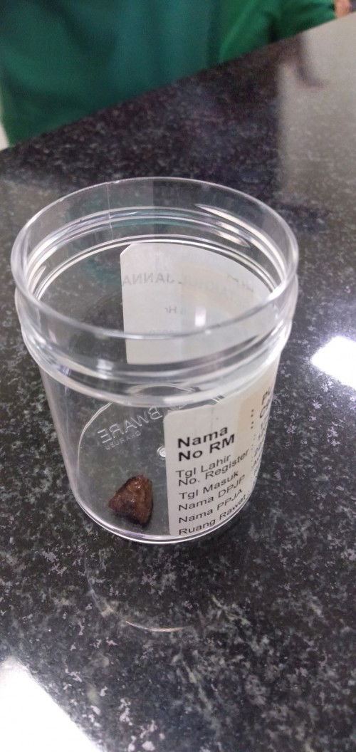 Potongan hati anakku ❤️‍🩹