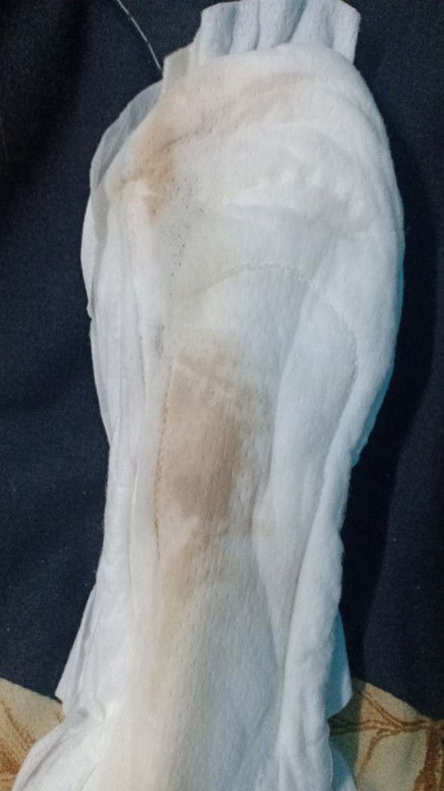 Turun tanda coklat dekat pad siapa² pernah tak mcmni?baru masuk 6 bulan risau