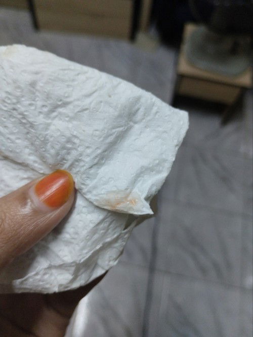 Darah period atau implantasi.. Sya period selalu ontime cuma kali ni lewat period sampai 5 hari n