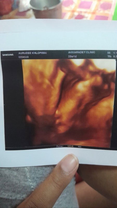 ทีมสิงหาคุณหมอว่าเด็กหญิง