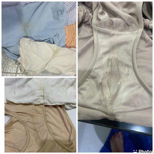 32+2W พอดีเปนริดสีดวงและมีอาการคันอักเสบแถวปากช่องคลอด 4วันที่ผ่านมามีน้ำใสๆไม่มีกลิ่นไหลออกมาตลอด ไปตรวจหมอบอกปกติ