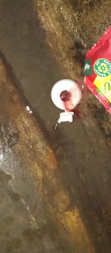 Sign na po ba ito na manganganak na ako?
Panay din po paninigas ang tiyan ko at masakit Balakang ko
