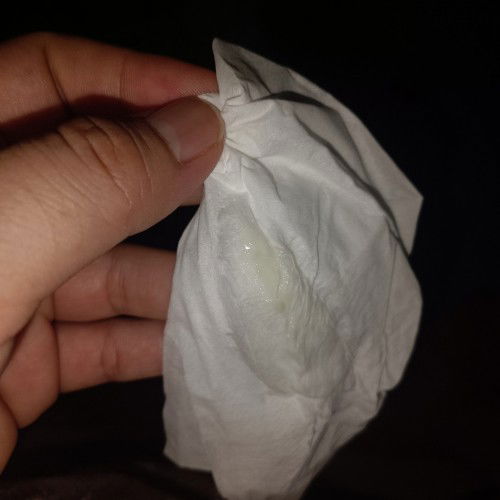 มูกใสหรือตกขาวดูยังไงคะ