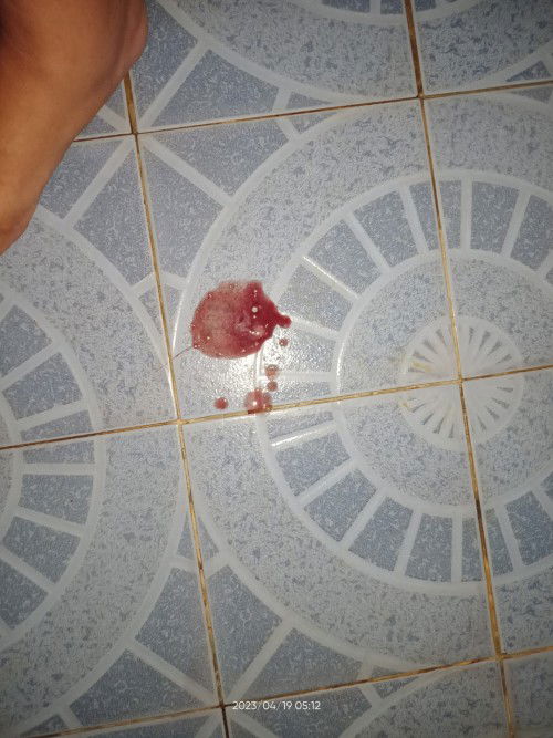 Keluar darah di hpl+8