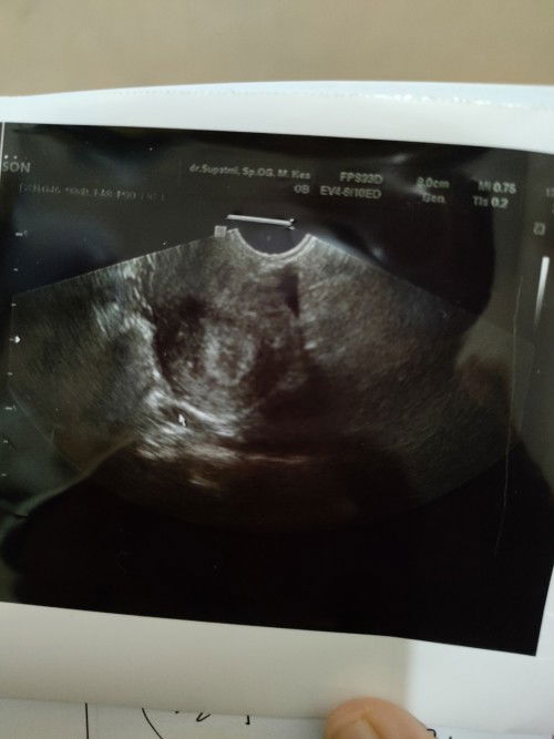 6 week masih penebalan dinding rahim