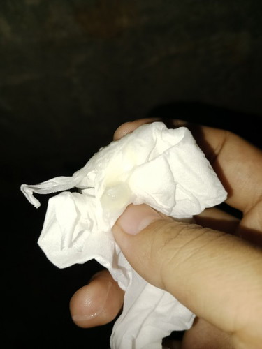มีแบบนี้ไหลออกมามันคืออะไรค่ะ