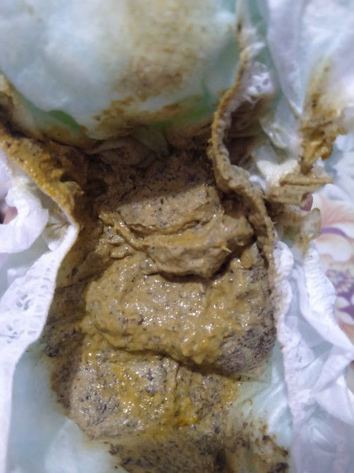 MGA mommy pa help🙏