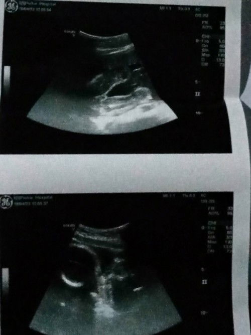 ช่วยดูน่อยค่ะว่าน้องเป็รเพศหญิงหรือเพศชาย