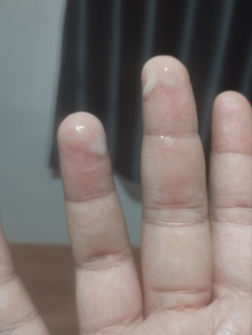 อายุครรภ์38+2