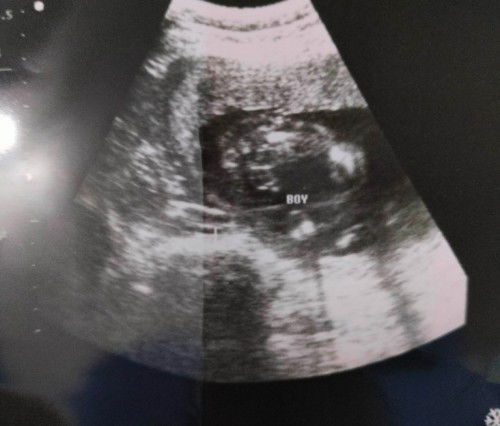 SURE NA BA ITO TALAGA?