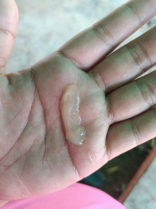 ท้องแรก 38+5w