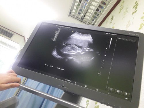 แบบนี้ผู้หญิงหรือผู้ชายคะขอสอบถามแม่ๆน่อยคะ ขอบคุณล่วงหน้าคะ😊🙏