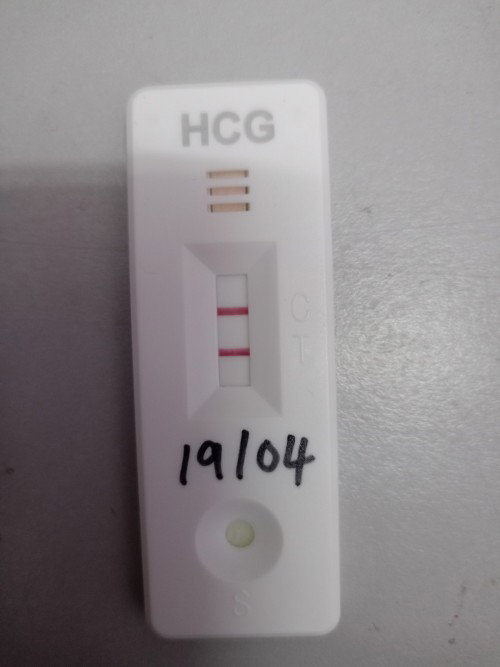 UPT Positif sebelum period. Normal ke?